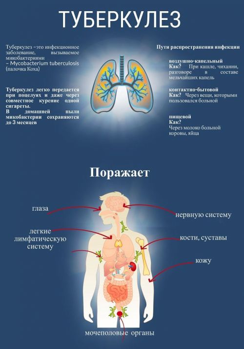 Палочка Коха: со дня открытия возбудителя туберкулеза прошло 100 лет
