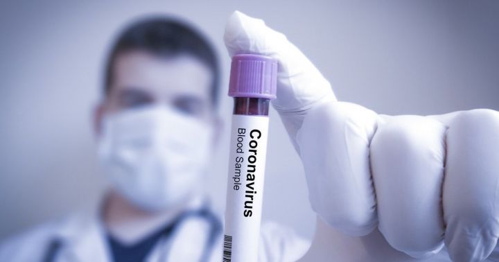 Сегодня в республике Татарстан подтверждено 39 новых случаев коронавирусной инфекции