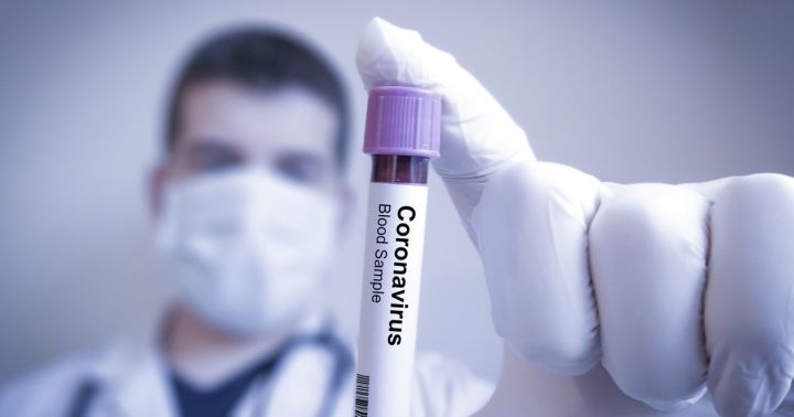 В Татарстане 63 новых случая заболевания коронавирусом