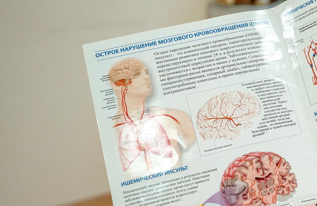 🧠 «В минуту гибнут миллионы нервных клеток»: почему нельзя перетерпеть инсульт