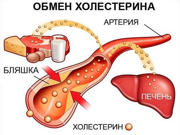 4 изменения, которые приведут холестерин в норму без таблеток